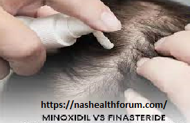 Finasteride and Minoxidil: Promote hair growth:- 4 Finasteride and Minoxidil: Promote hair growth:-