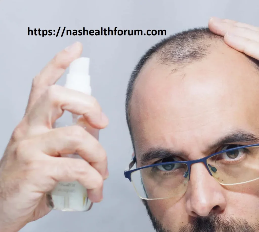 Finasteride and Minoxidil: Promote hair growth:- 3 Finasteride and Minoxidil: Promote hair growth:-