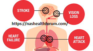 Study shows sharp increase in high blood pressure deaths linked to kidney disease:- 4 Study shows sharp increase in high blood pressure deaths linked to kidney disease:-